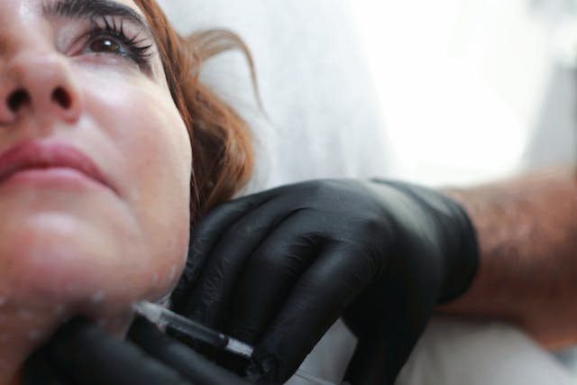 Before and After Dermal Fillers: Key Information You Need to Know
