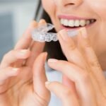 Transforming Your Smile: The Impact of Teeth Straightening